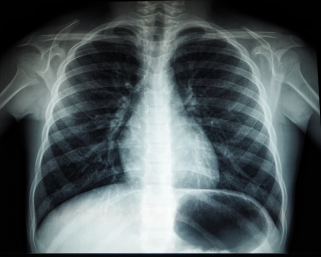 Radiology